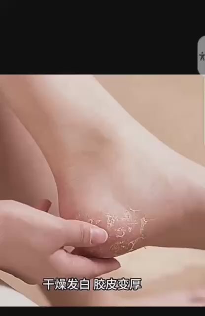 Pedicure Grinding Tool